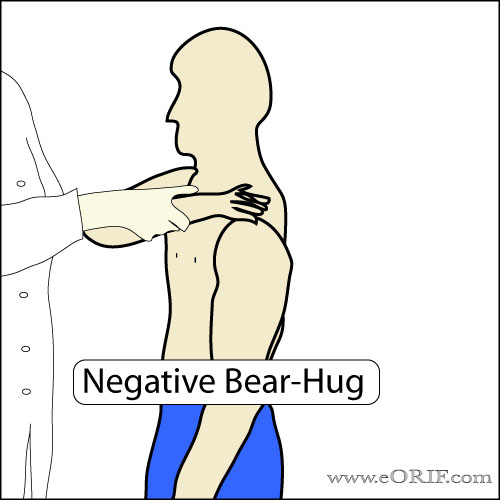 Bear Hug Test picture