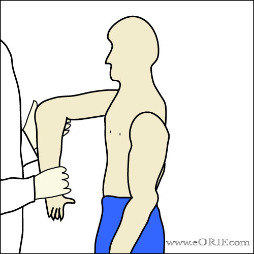 Coracoid Impingement Sign