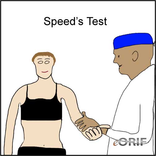 Speed's test