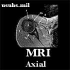 MRI Axial