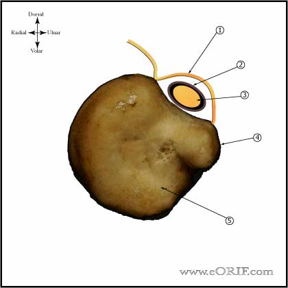 extensor carpi ulnaris image