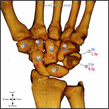 Carpal Ossification Sequence picture