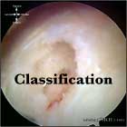 Rotator cuff tear classification