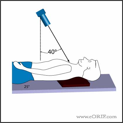 Serendipity View Shoulder Xray