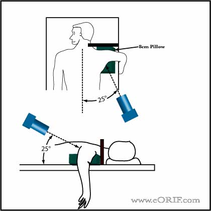 West Point Axillary View Shoulder Xray