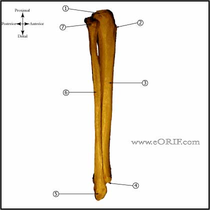 Tibia and Fibula lateral view