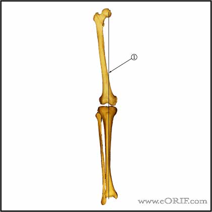 Lower limb mechanical axis image